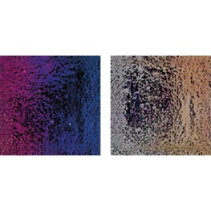 EC 60 2x2 JNJ Mosaic