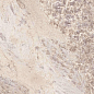 LU628373 Select Gem Rose Lucido 8mm 60x120 IRIS FMG