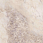 LU628373 Select Gem Rose Lucido 8mm 60x120 IRIS FMG