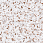 CH09XPL Charm Pink Lap.SQ. 6mm 120x280 Italgraniti